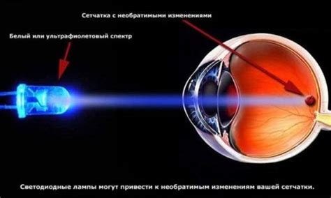 Влияние паров антифриза на органы зрения