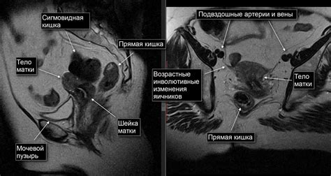 Воздействие Афалазы на органы малого таза