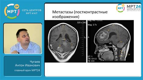 Диагностика гипоплотного образования