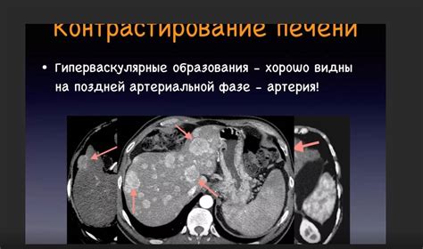Лечение гипоплотного образования