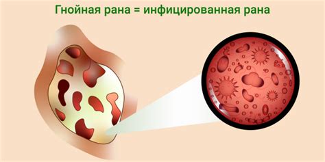 Основные признаки и симптомы поноса, вызванного употреблением иван-чая