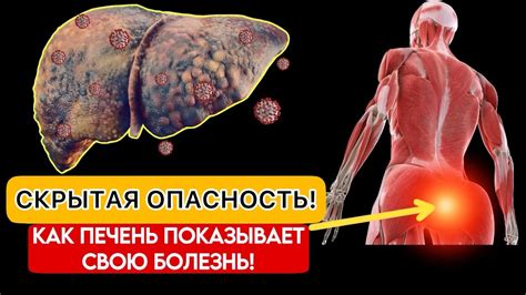 Признаки проблем с клапаном: как их распознать