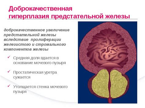 Применение Афалазы и Омника при аденоме простаты: сравнение эффективности