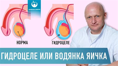 Причины образования отложений в области яичек у мужского организма
