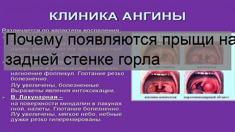 Размещение идентификационного кода на задней стенке немецкого полуприцепа