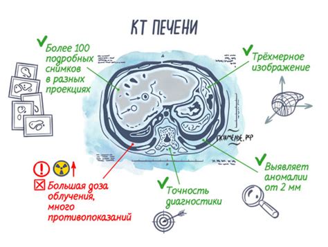 Что такое гиподенсное образование
